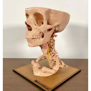 Nervio Glosofaríngeo